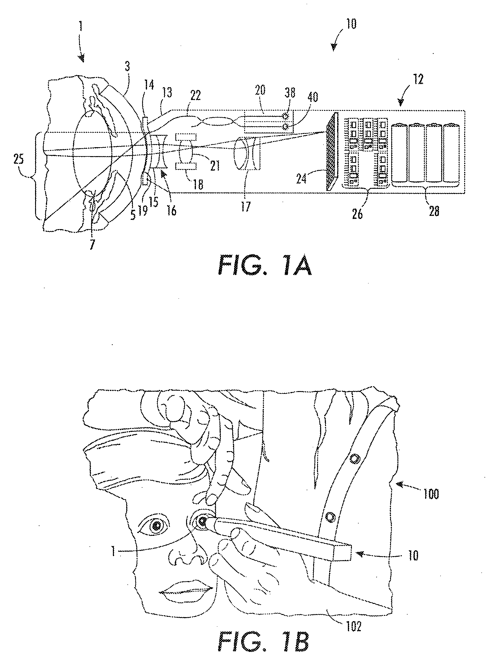 Portable fundus camera