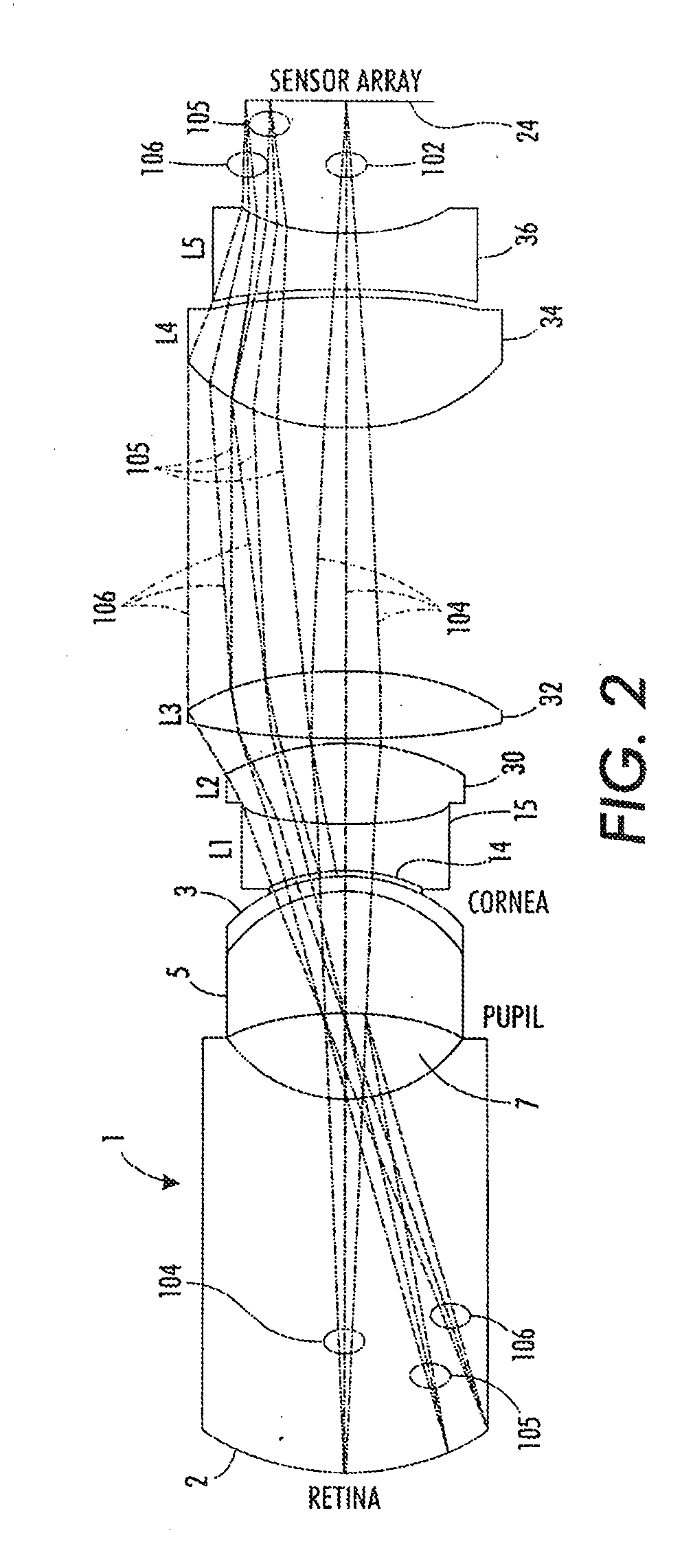 Portable fundus camera