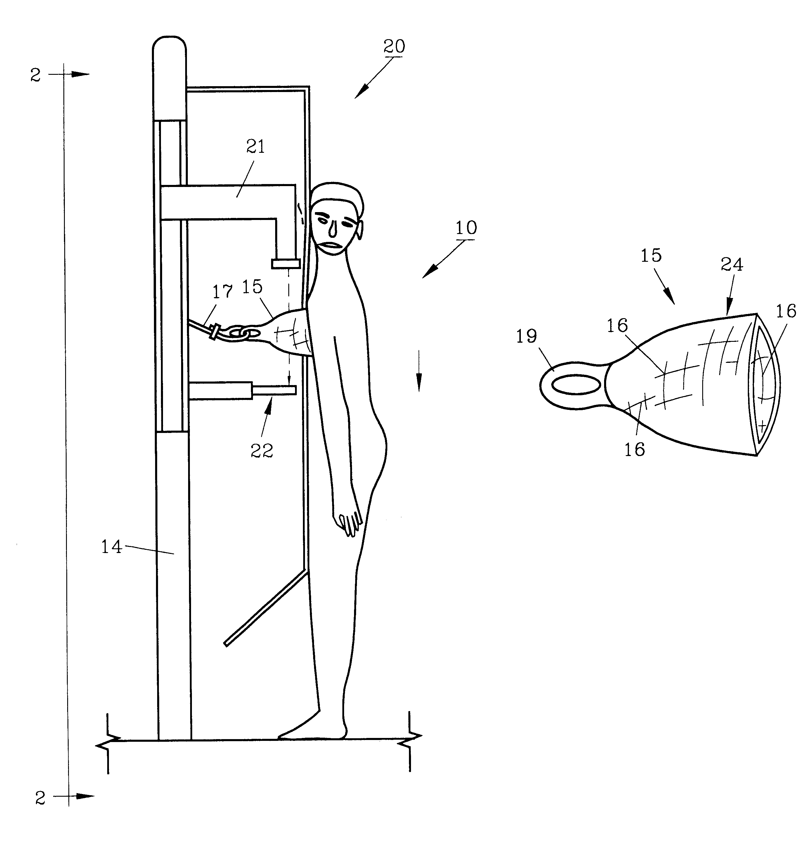 Radiation breast cup and method