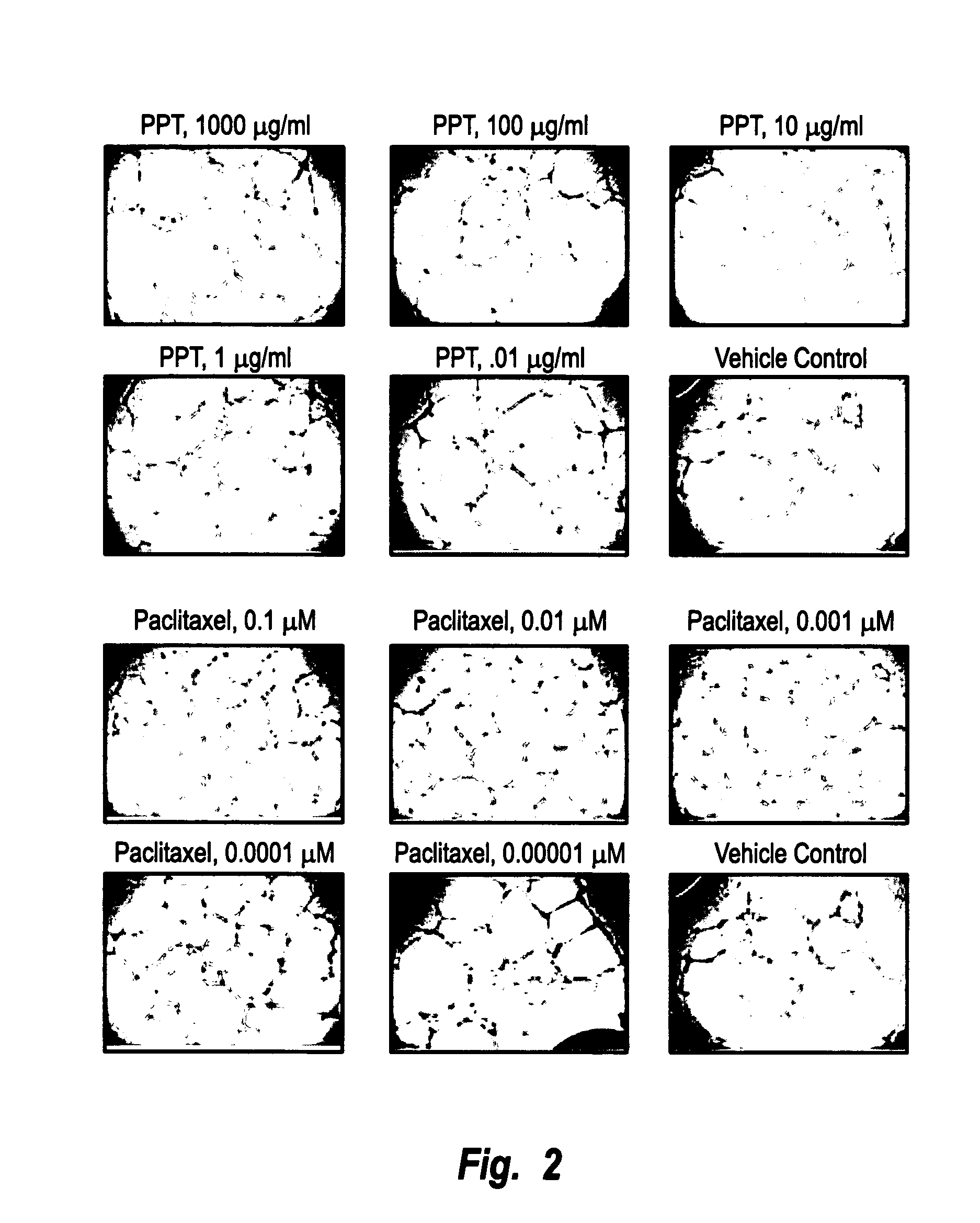 Morinda citrifolia-based formulation for inhibiting metastasis of carcinogenic cells