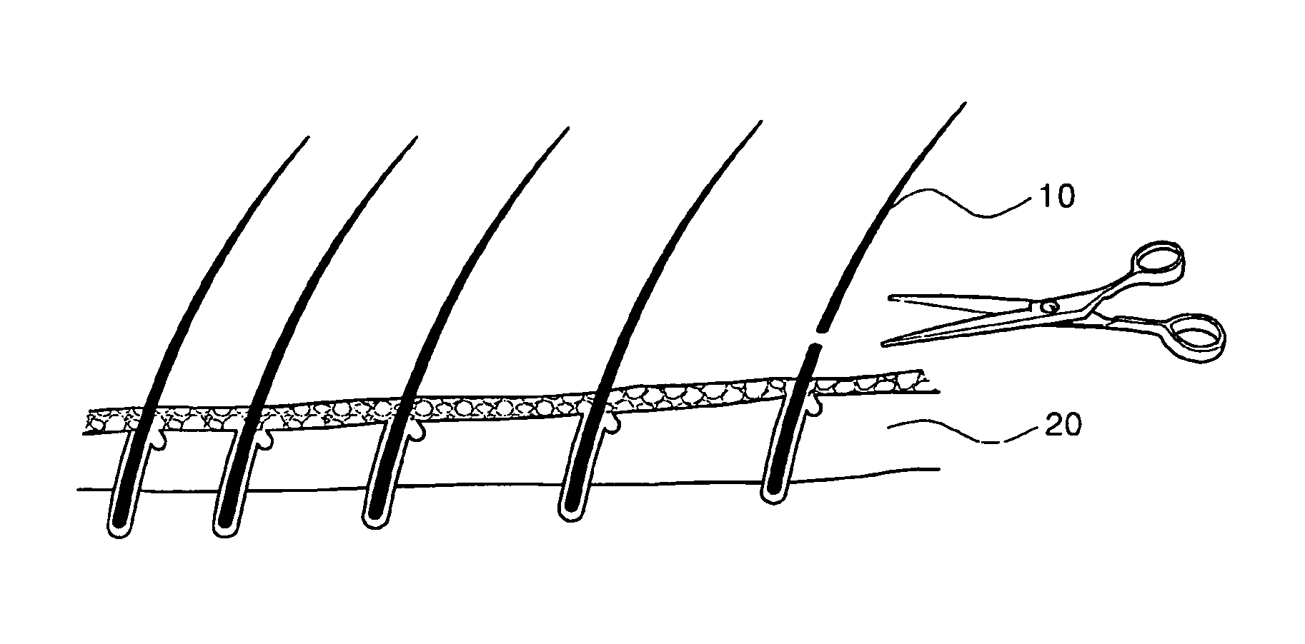 Structure of natural or artificial hair for transplantation and hair transplantation method using the same