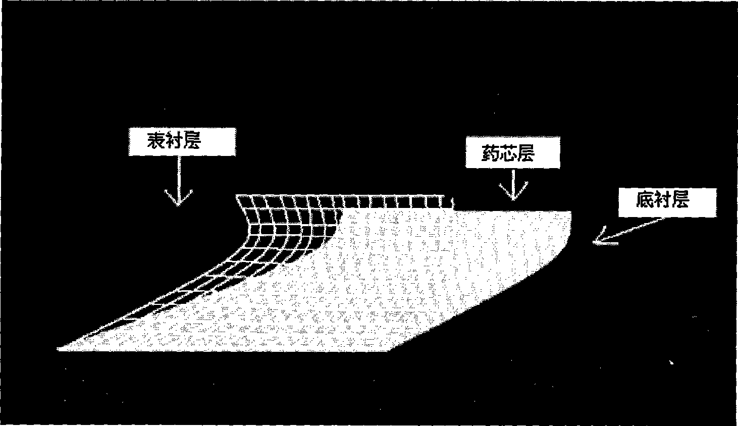 Brassiere paster for preventing and treating hyperplasia of mammary glands and preparation method thereof