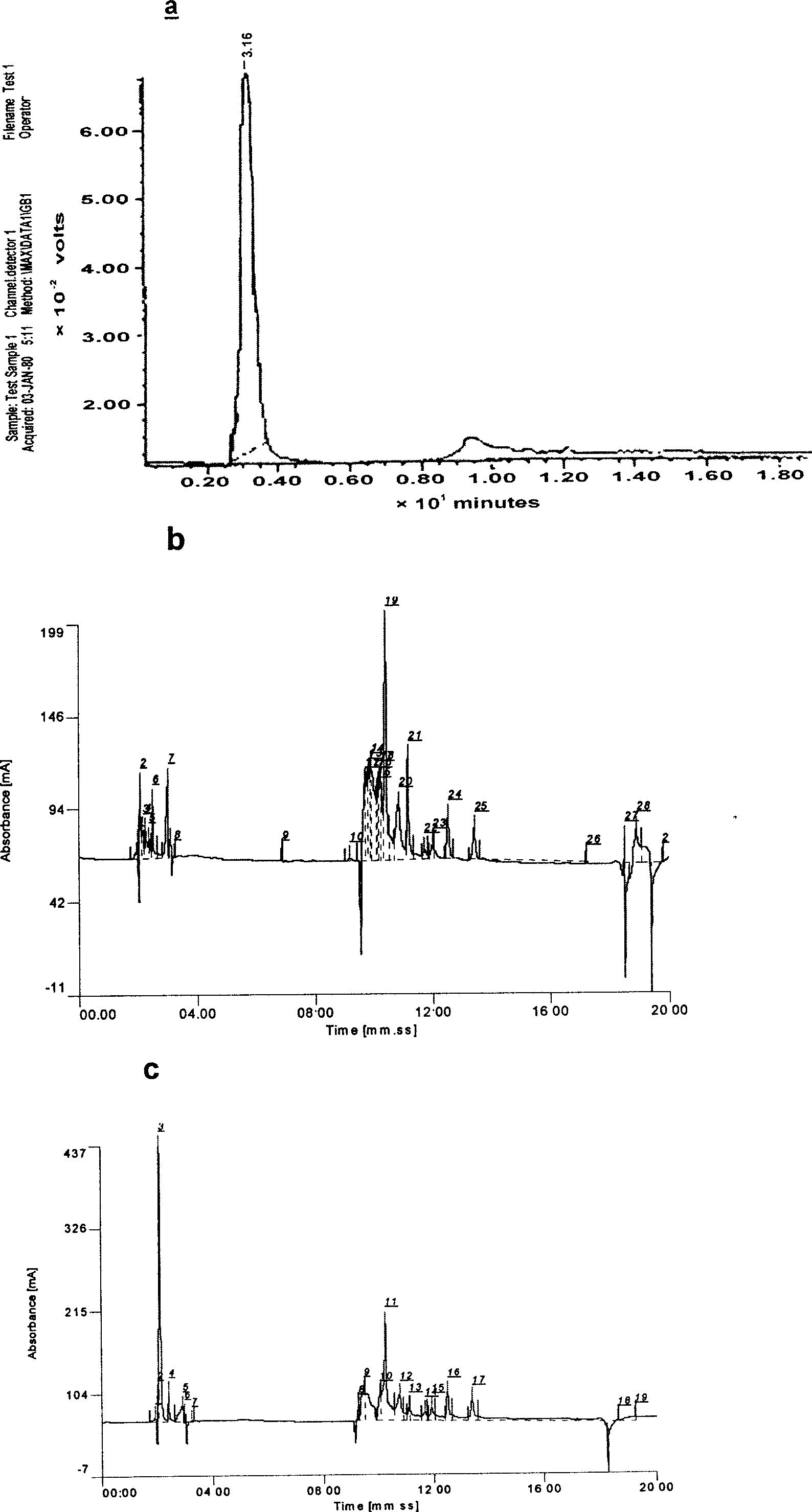 Brassiere paster for preventing and treating hyperplasia of mammary glands and preparation method thereof