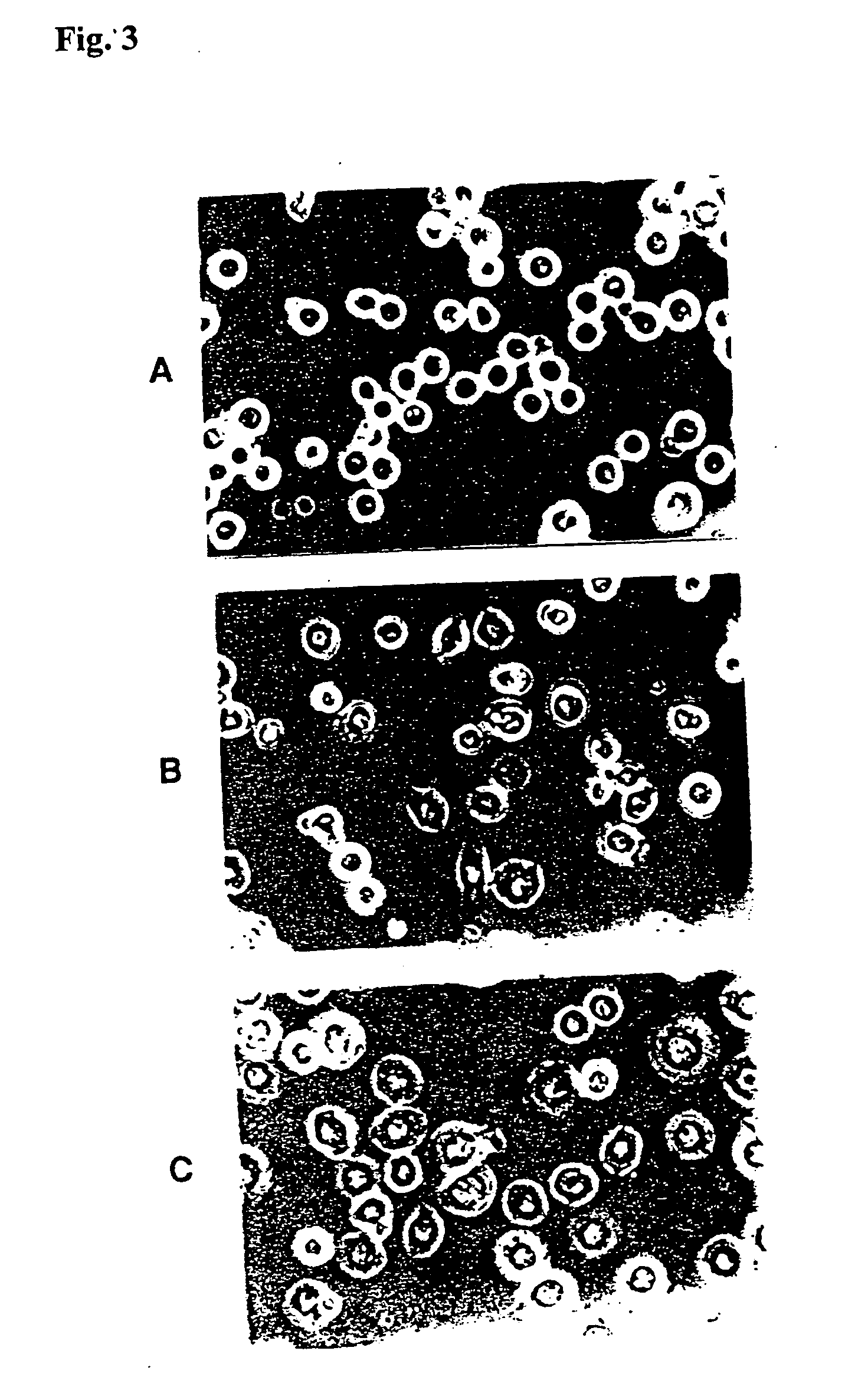 Soluble recombinant alphavbeta3 adhesion receptor