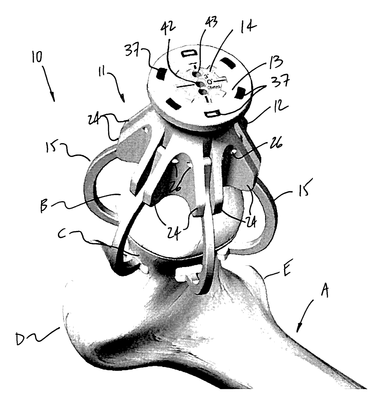 Hip resurfacing drill guide device