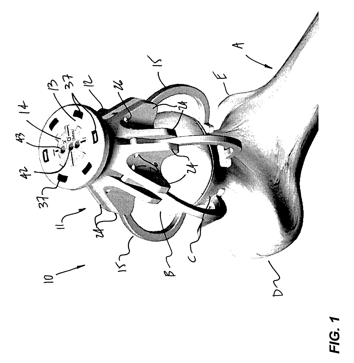 Hip resurfacing drill guide device