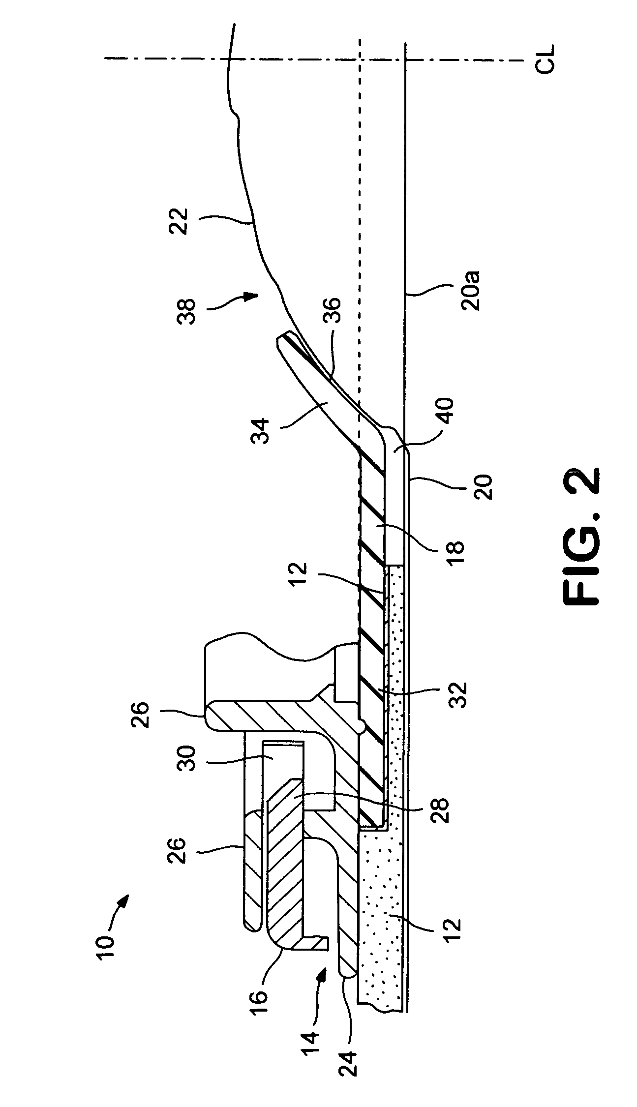 Ostomy appliance having pressure applying member