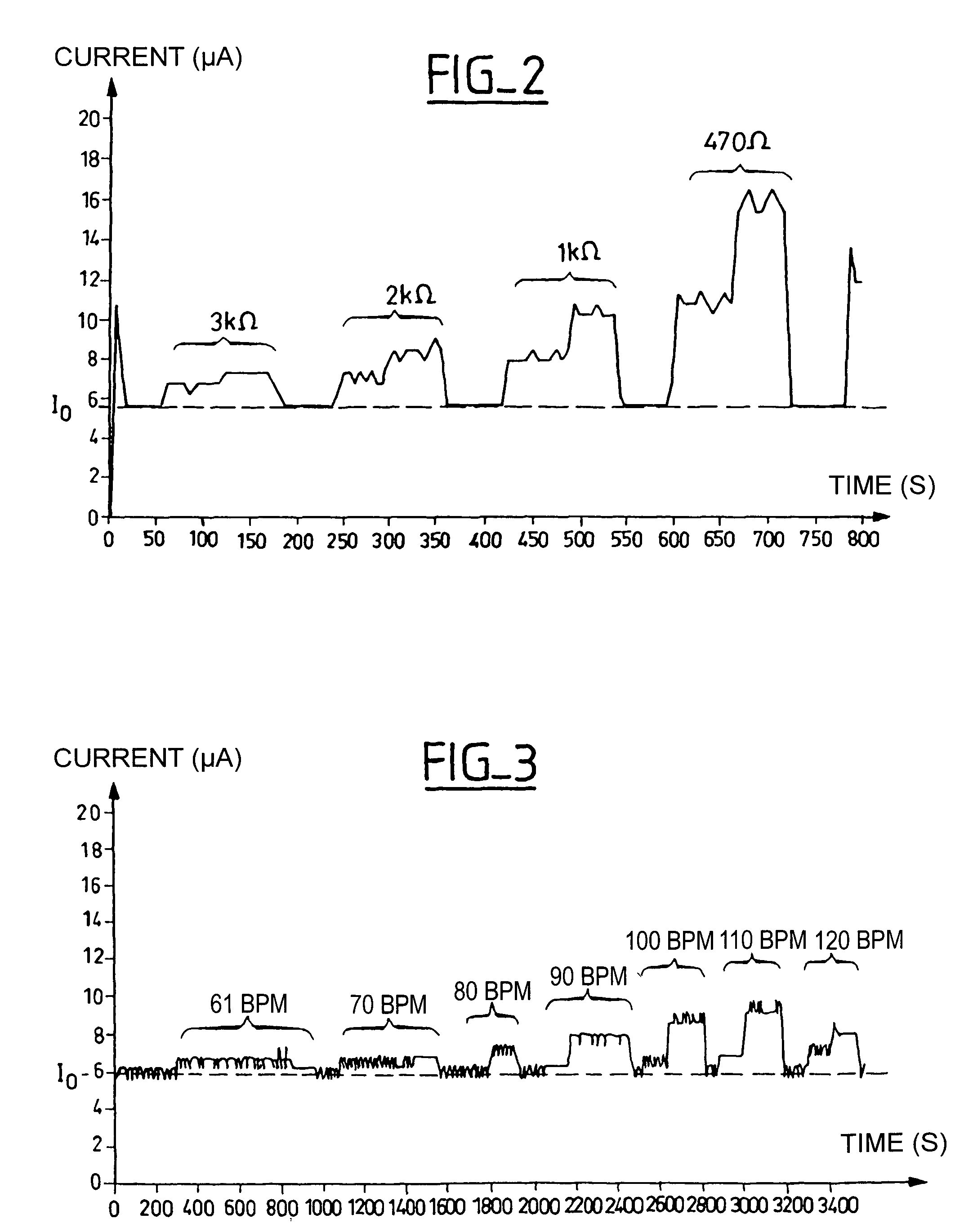 Implantable cardiac pacemaker with automatic control of the connection of a probe and the implantation of the case