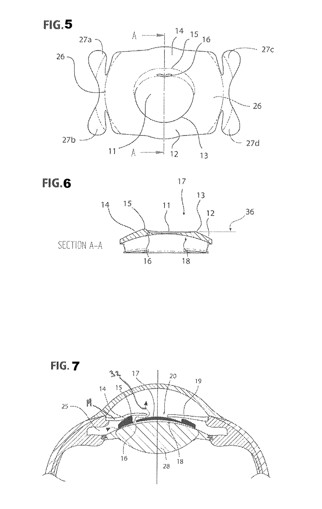 Intraocular lens