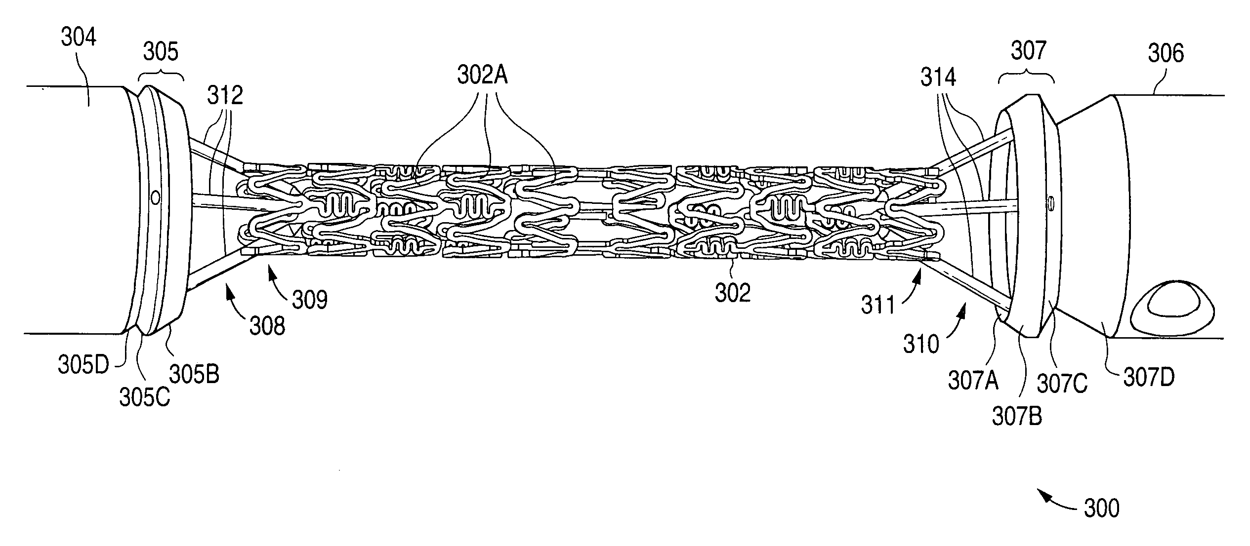 Rotatable support elements for stents