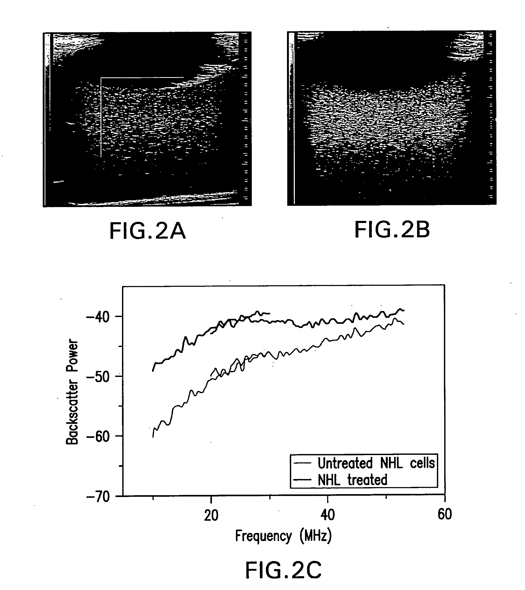 Methods of monitoring cellular death using low frequency ultrasound