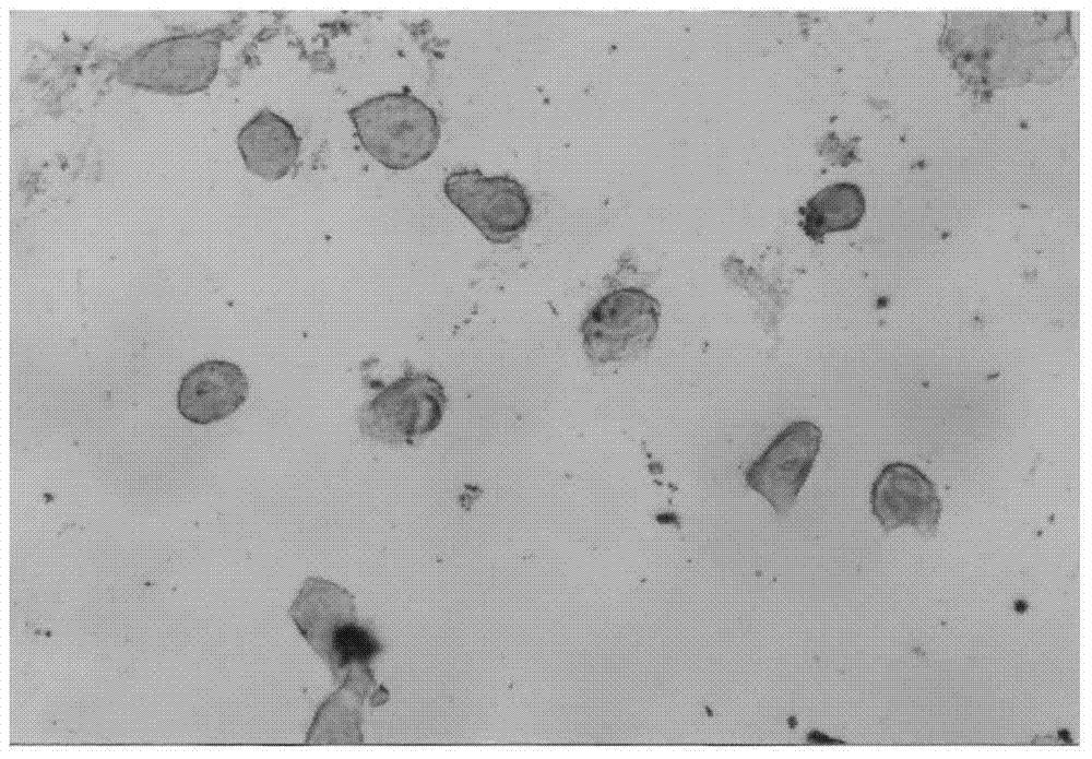 Traditional Chinese medicine composition for treating climacteric syndrome, and preparation method and quality detection method thereof