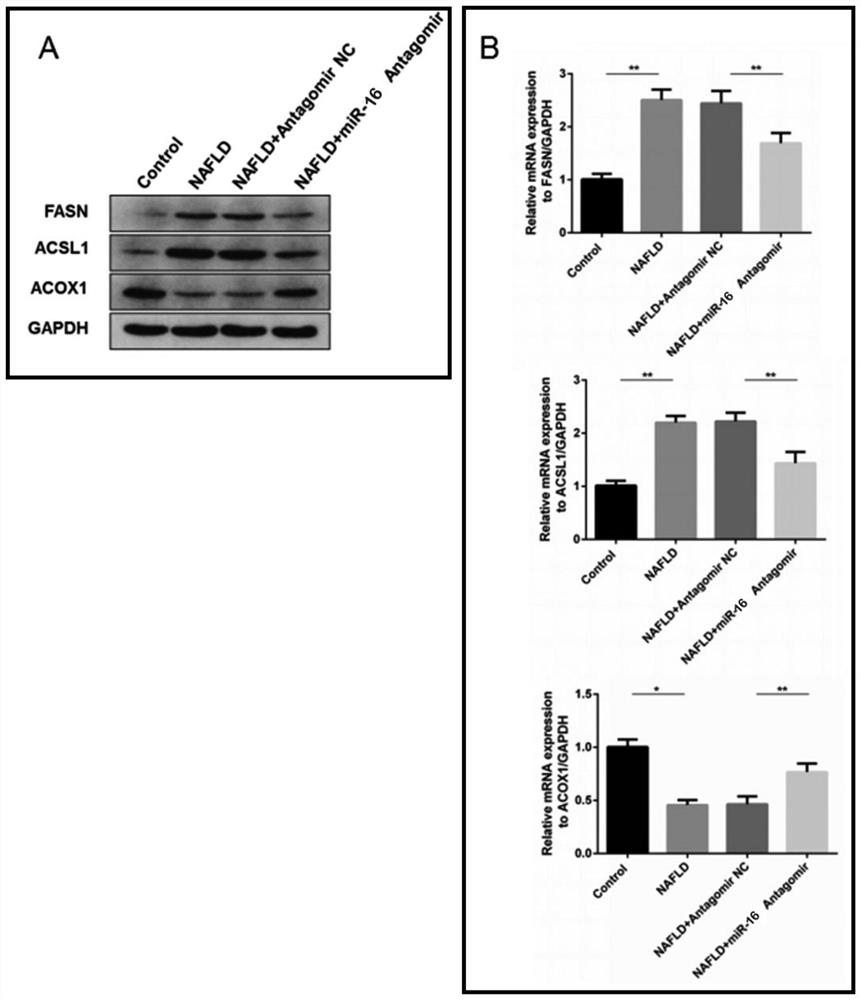 Application of mir-16 antagonist in the preparation of drugs for inhibiting non-alcoholic fatty liver disease