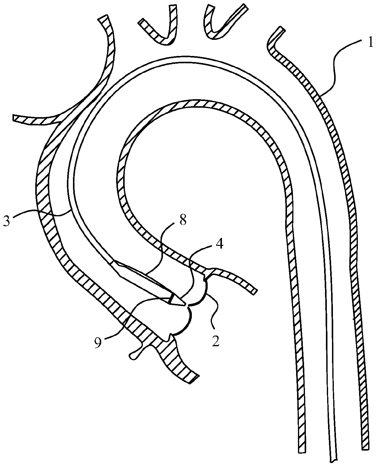 Bendable intervention valve conveying system