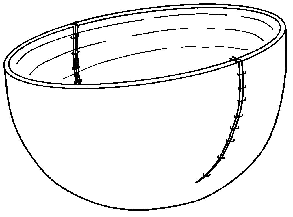 Breast implant support device based on periplast material and preparation method thereof