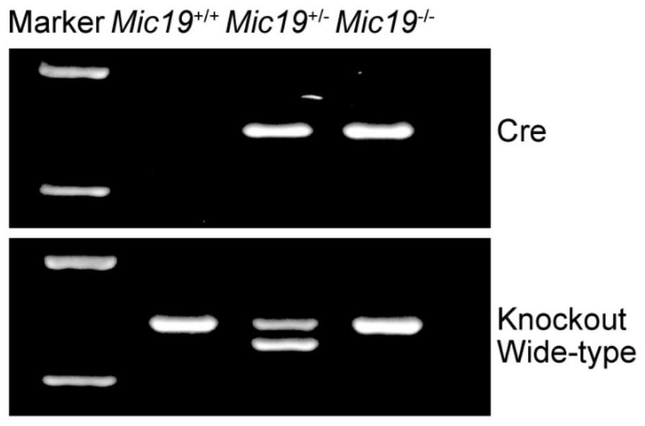 Construction method and application of a kind of epilepsy animal model