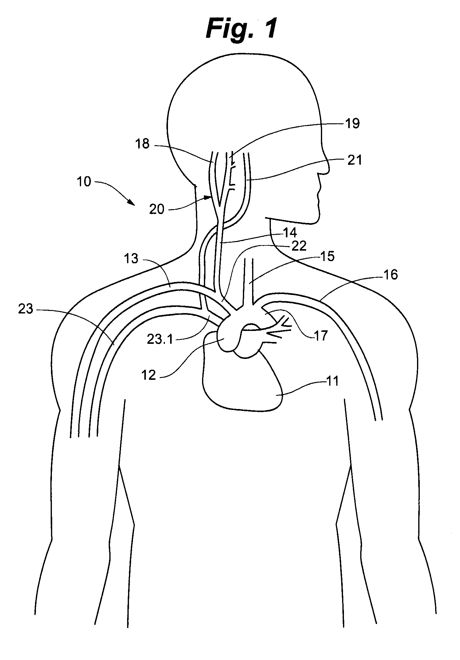 Method for monitoring physiological cycles of a patient to optimize patient therapy