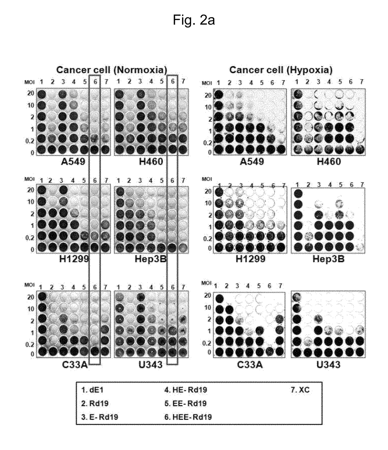 Gene delivery system having enhanced tumor-specific expression, and recombinant gene expression regulating sequence