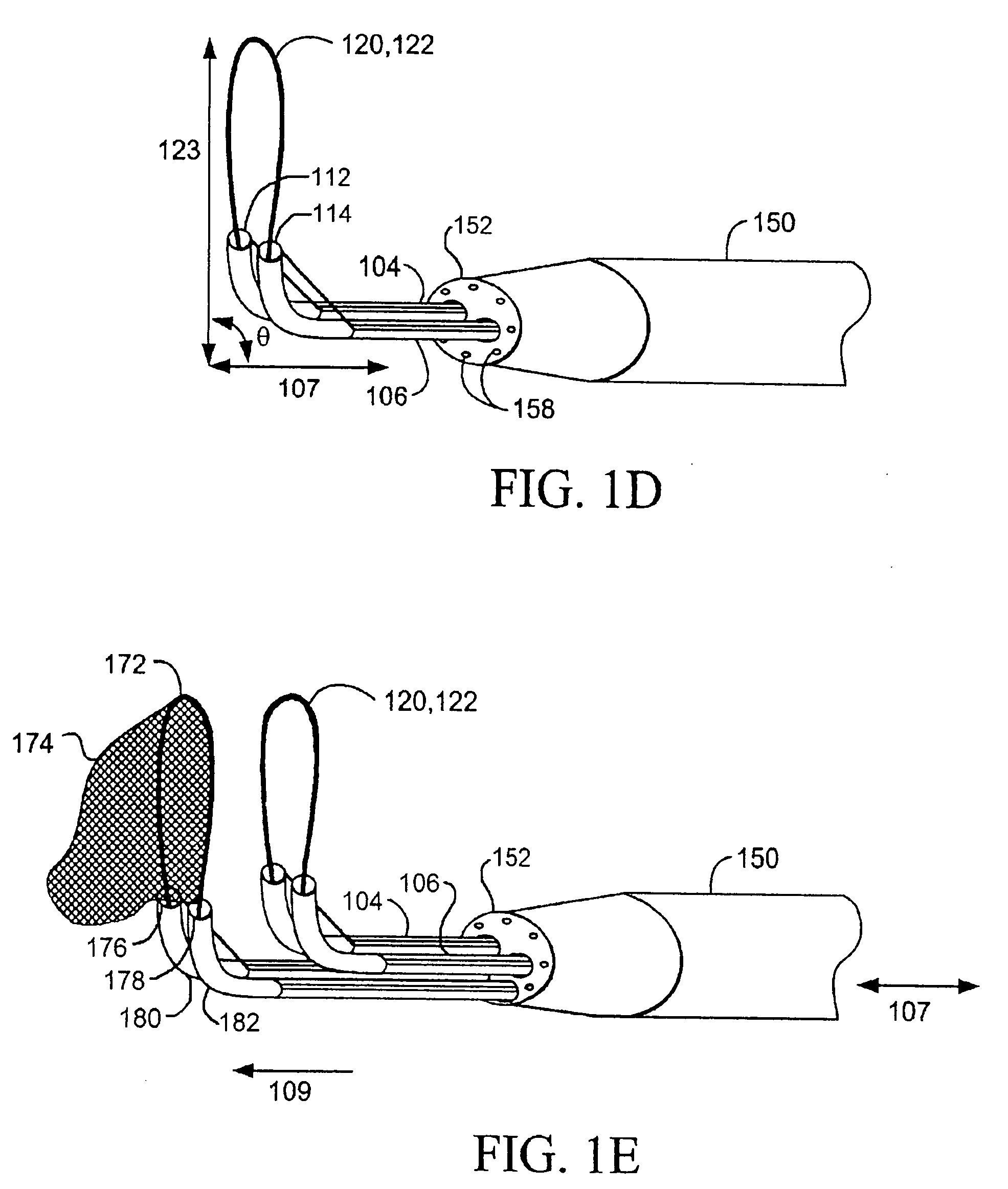 Devices and methods for tissue severing and removal