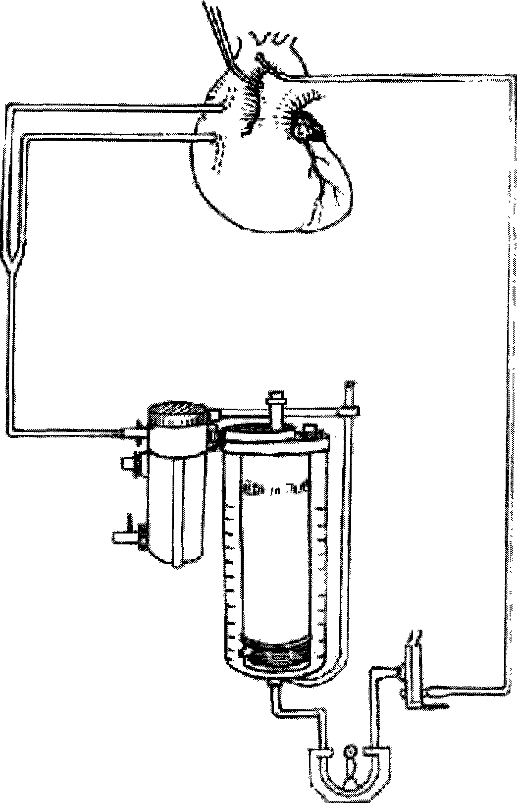 Extracorporeal circulation self oxygen system for in-situ curing the pulmonary function injury