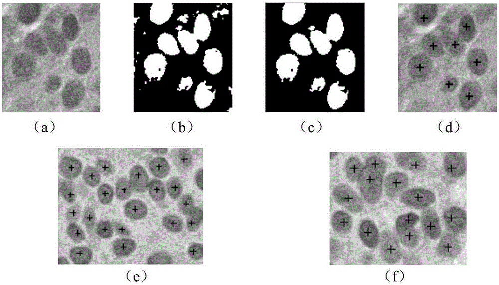 Synechia cell image segmenting method based on polyphase mutual exclusion level set