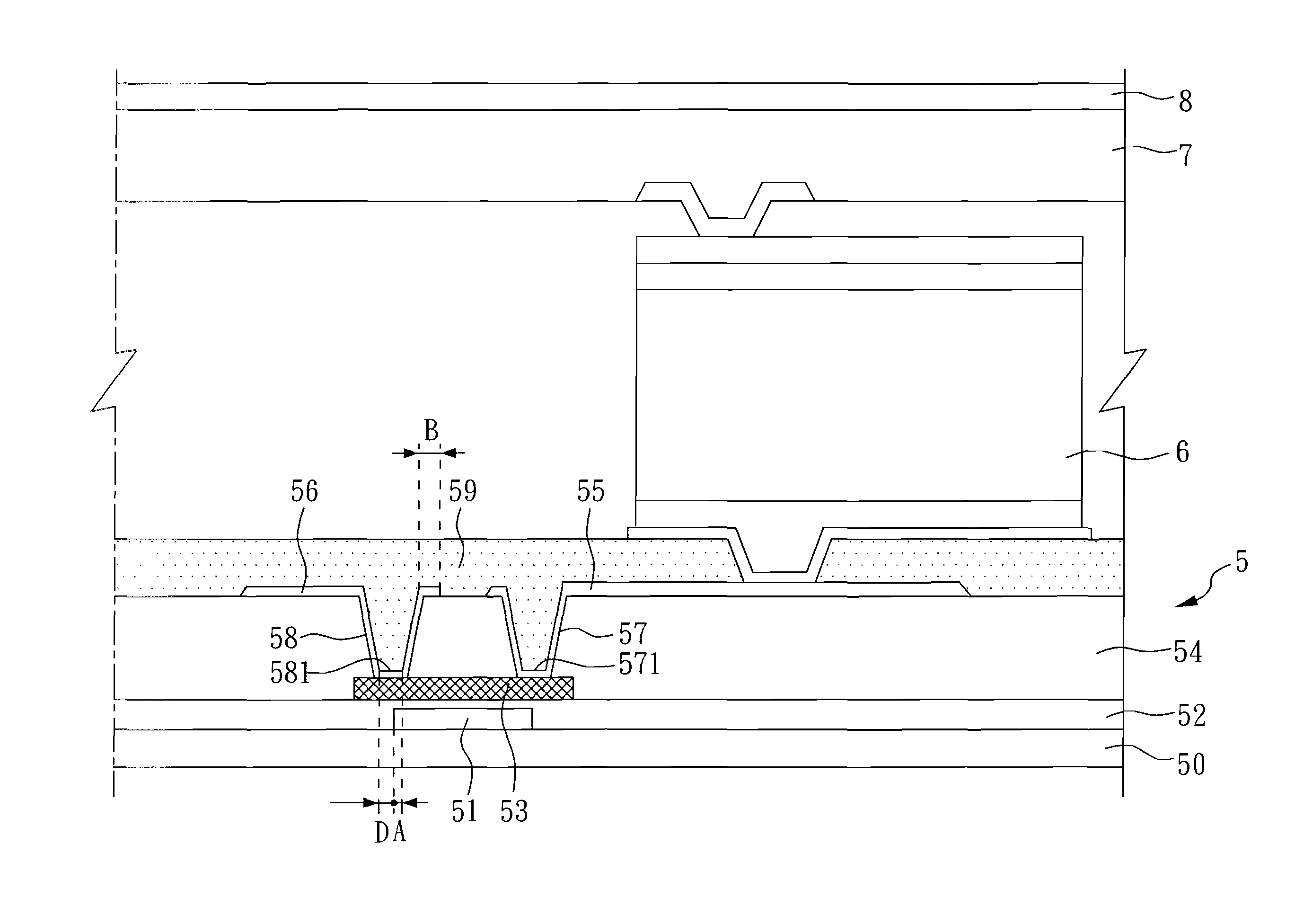 X-ray detector