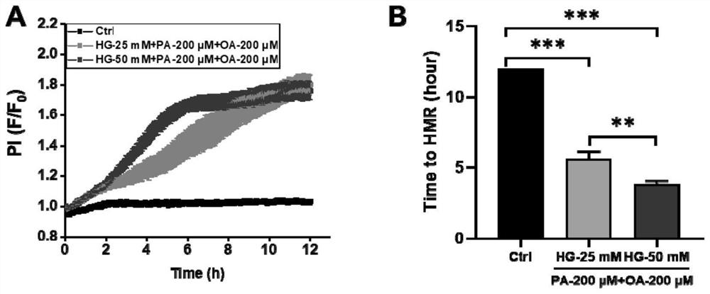 Construction method and application of acute pancreatitis cell model