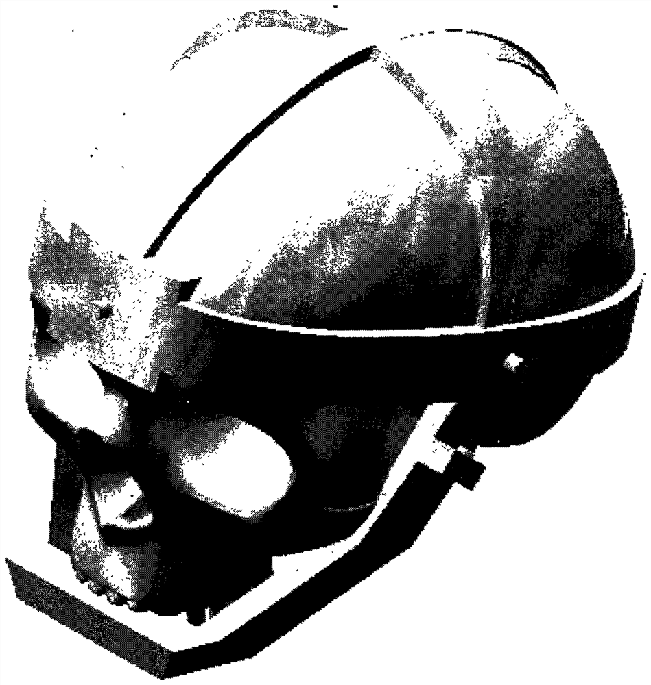 Craniotomy positioning guide template for neurosurgery