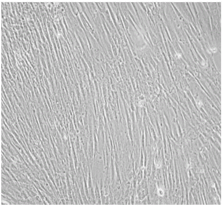 Culture medium for inducing adipogenic differentiation of muscle derived stem cells of skeletal muscles, and application and adipogenic differentiation method thereof