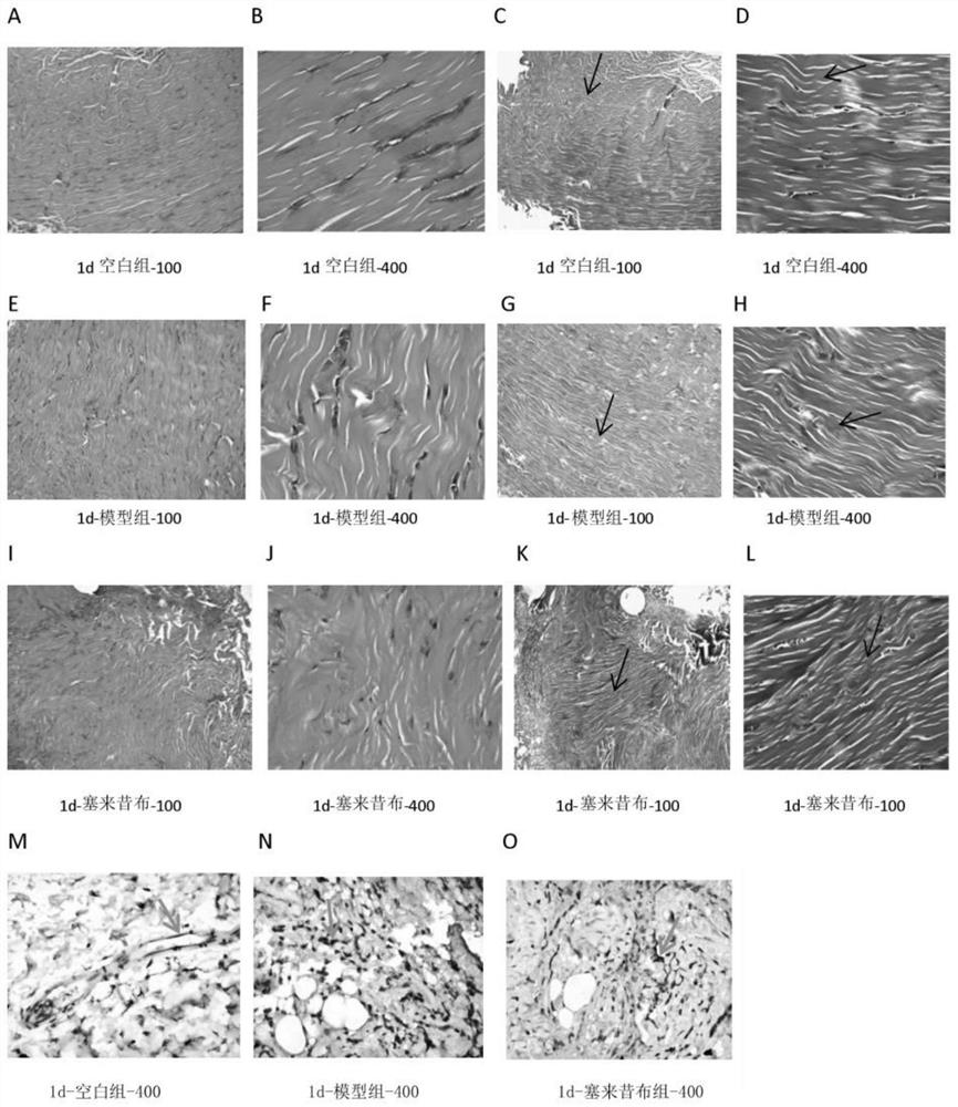 Biomarker related to tendon injury