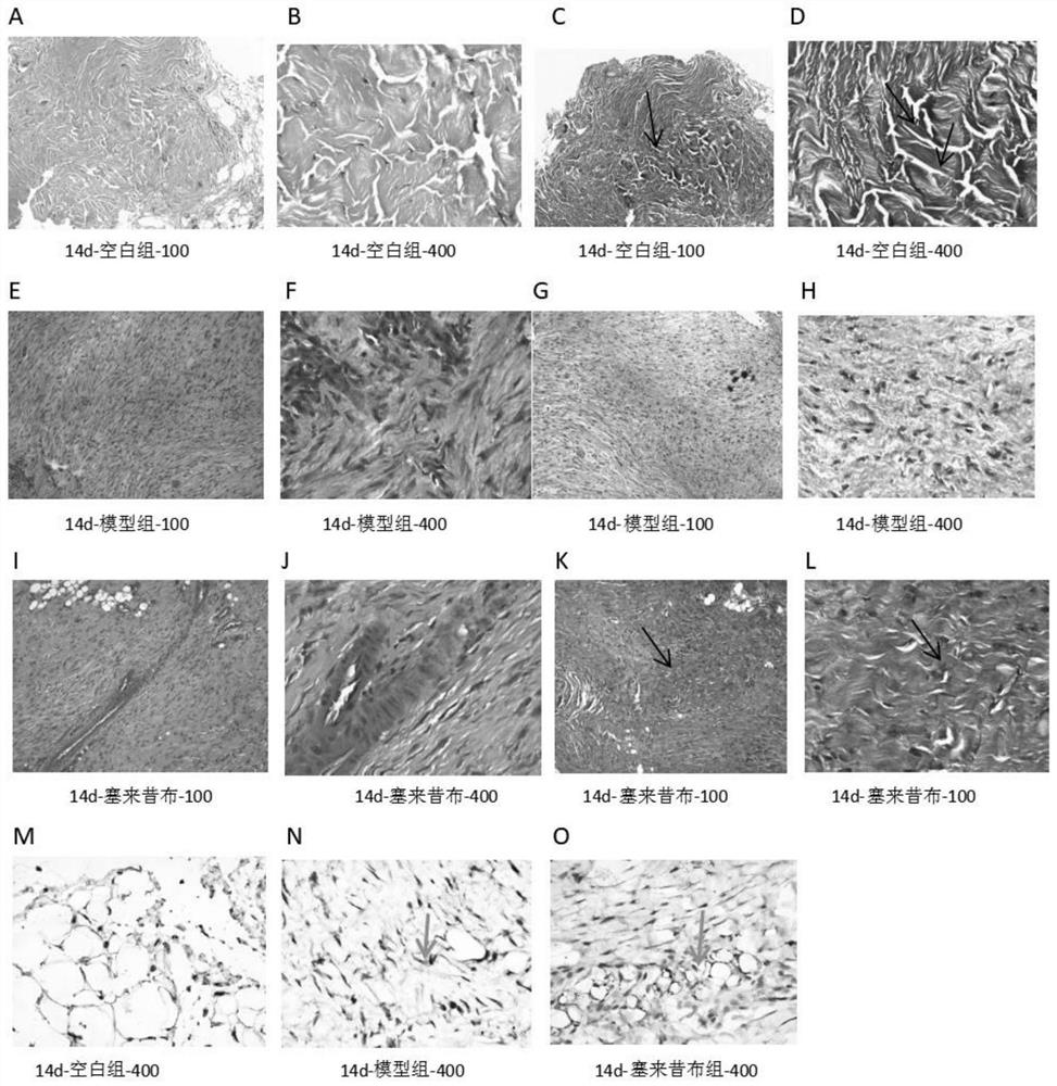 Biomarker related to tendon injury