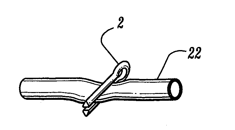 Method for blood vessel clip application