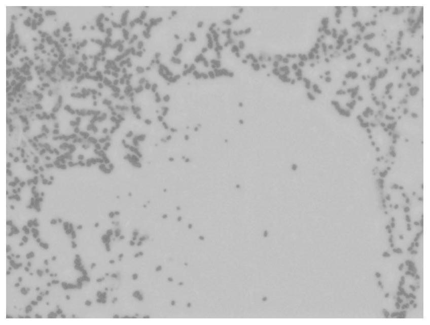 Microbial remediation method for heavy metal contaminated soil in retired slag yard of smelting plant