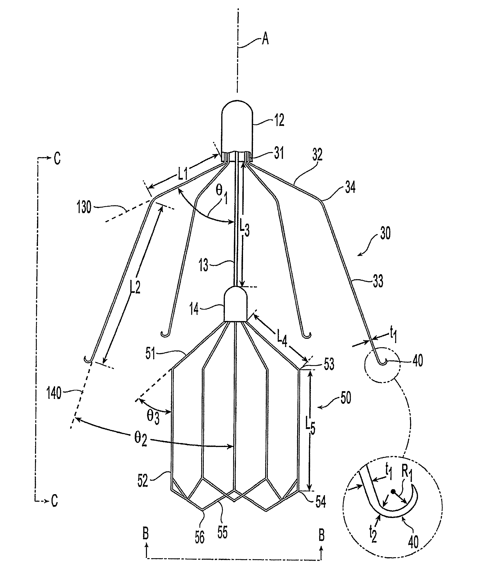 Embolus blood clot filter with floating filter basket