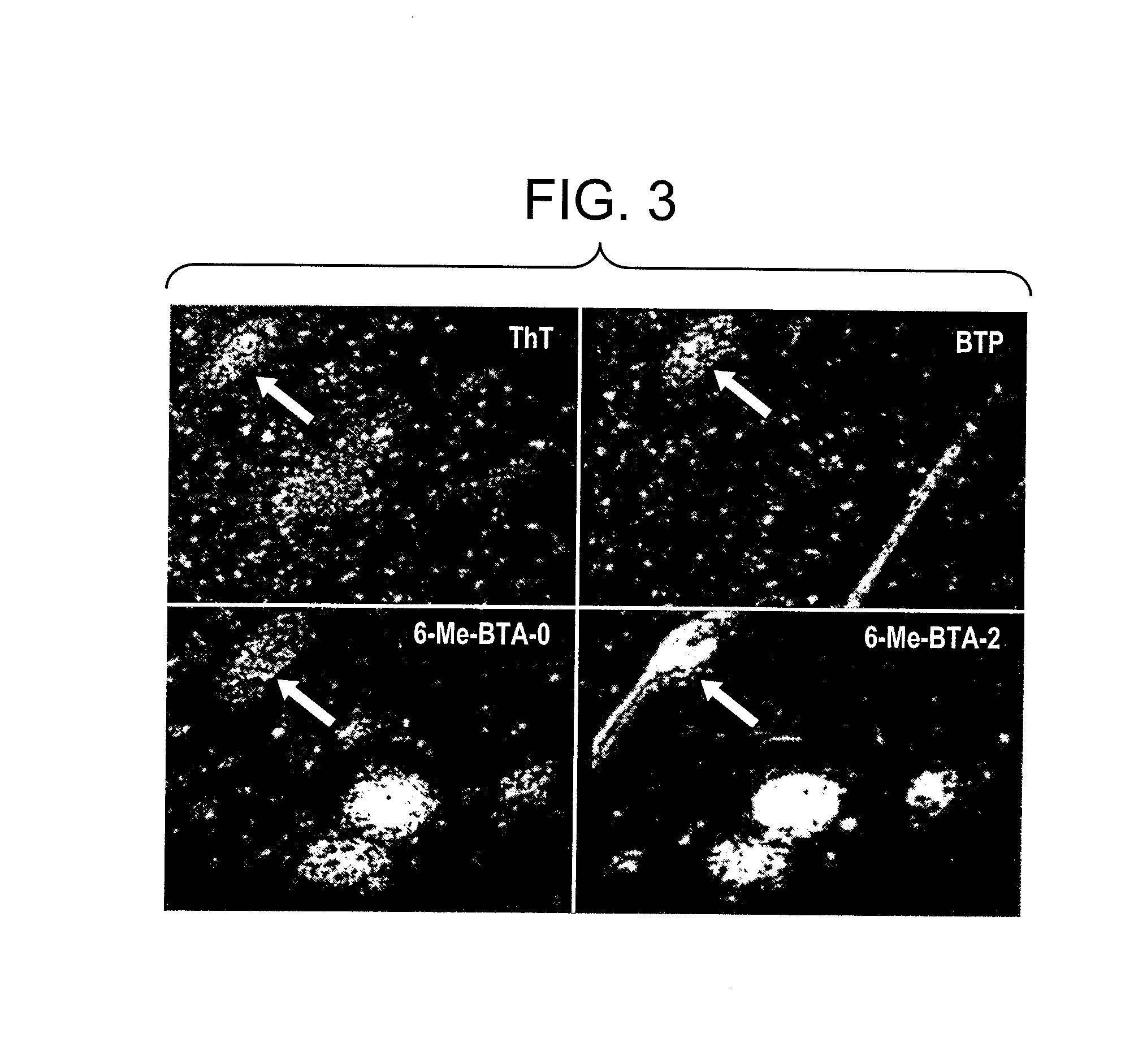 Thioflavin derivatives for use in antemortem diagnosis of alzheimer's disease and in vivo imaging and prevention of amyloid deposition