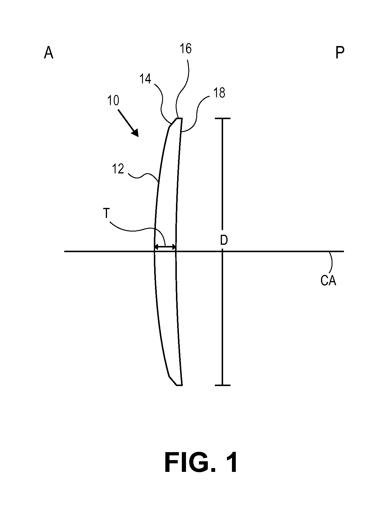 Methods of correcting vision