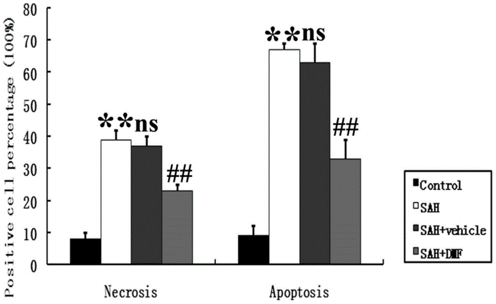 Application of dimethyl fumarate in the preparation of drugs for treating early brain injury after subarachnoid hemorrhage