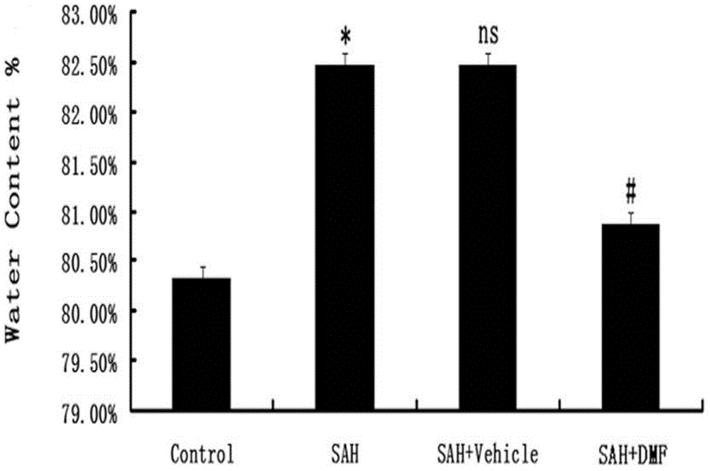 Application of dimethyl fumarate in the preparation of drugs for treating early brain injury after subarachnoid hemorrhage