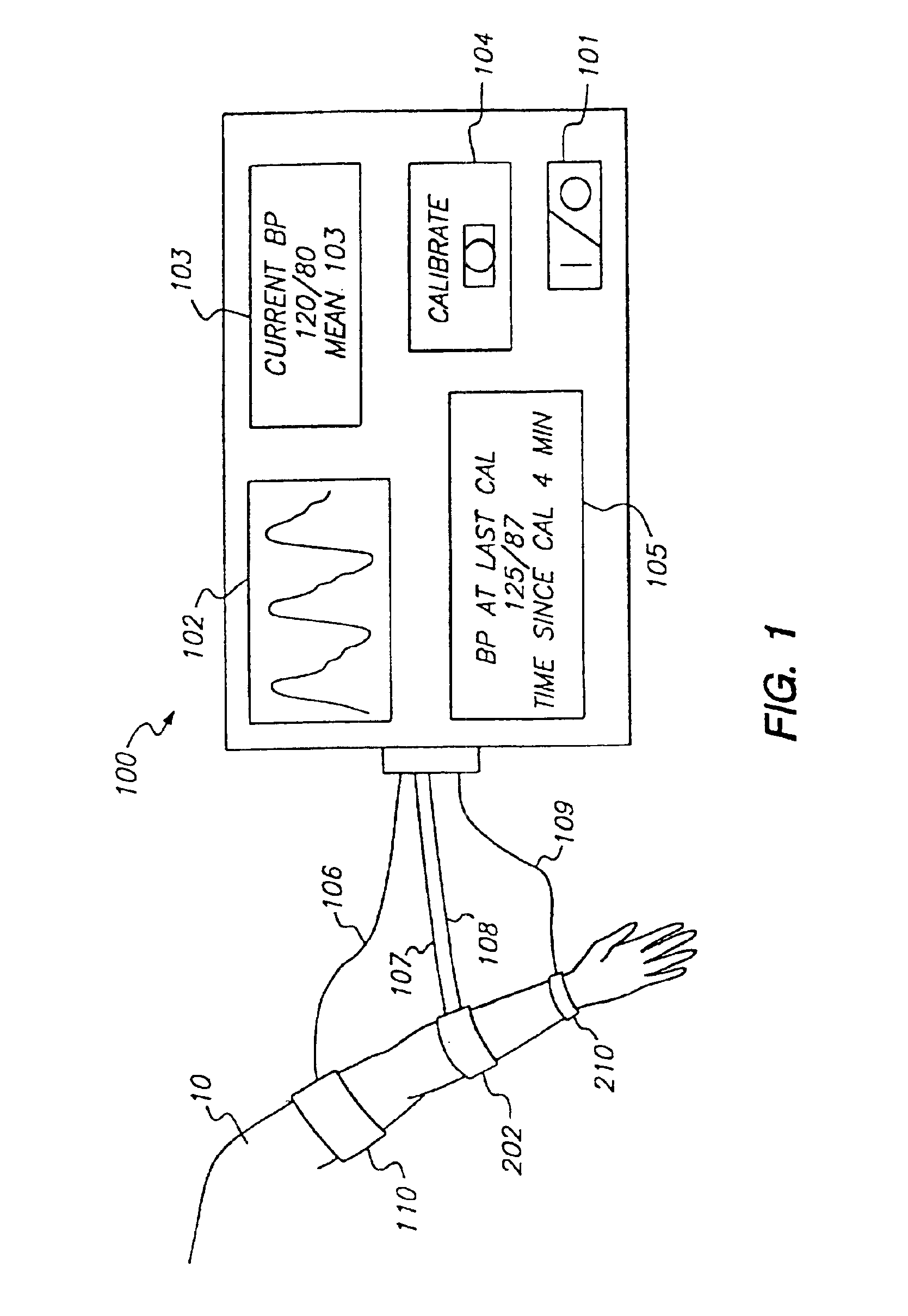 System and method of determining whether to recalibrate a blood pressure monitor