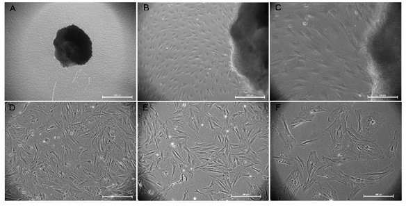 A kind of in vitro culture and purification method of perineurial cells