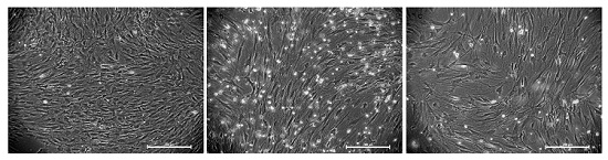 A kind of in vitro culture and purification method of perineurial cells