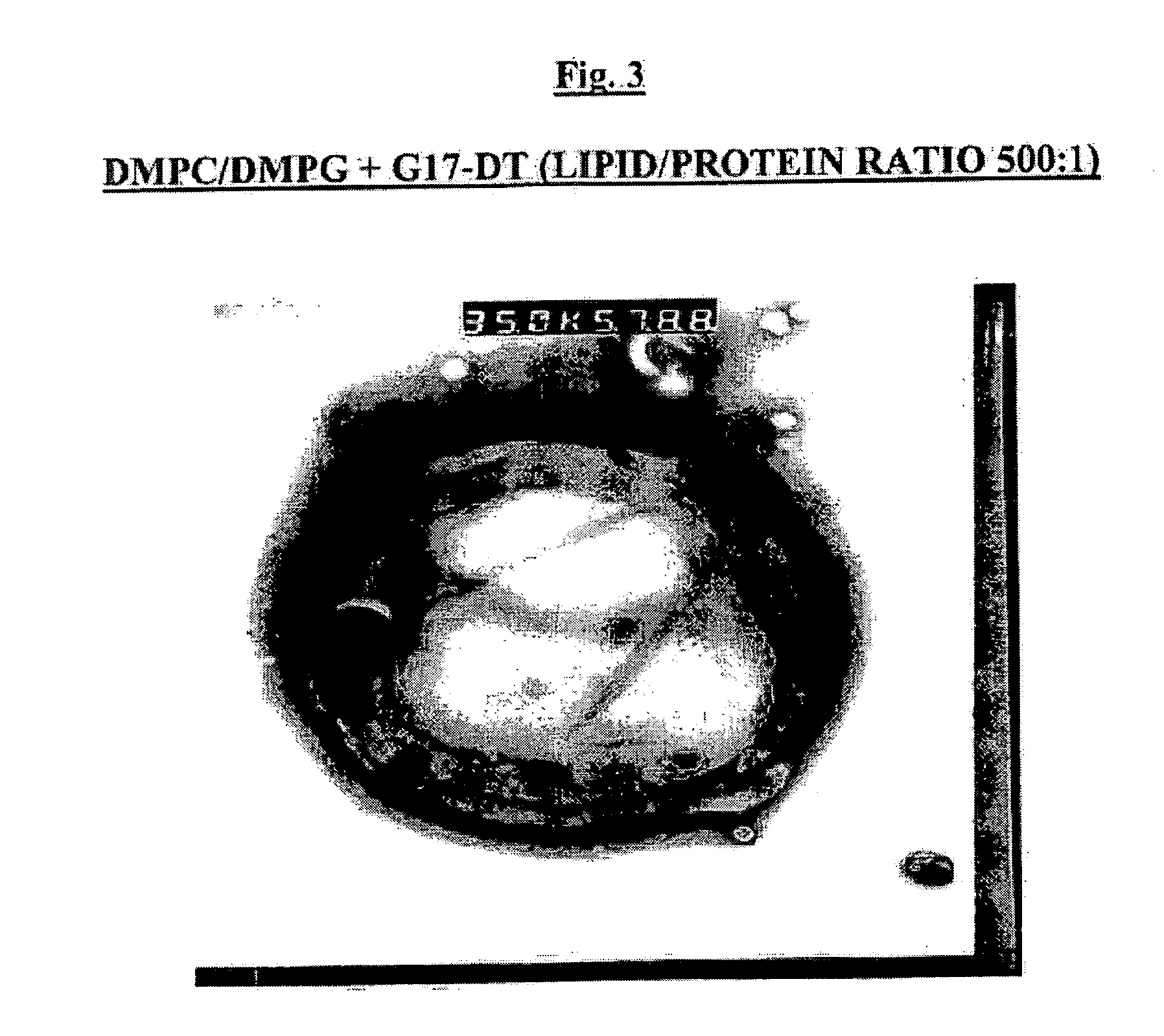 Liposomal vaccine