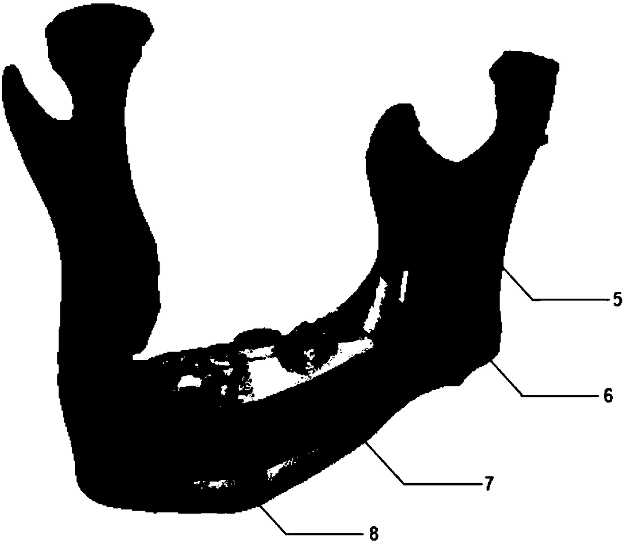 Lower jawbone position information recording method based on guide plate