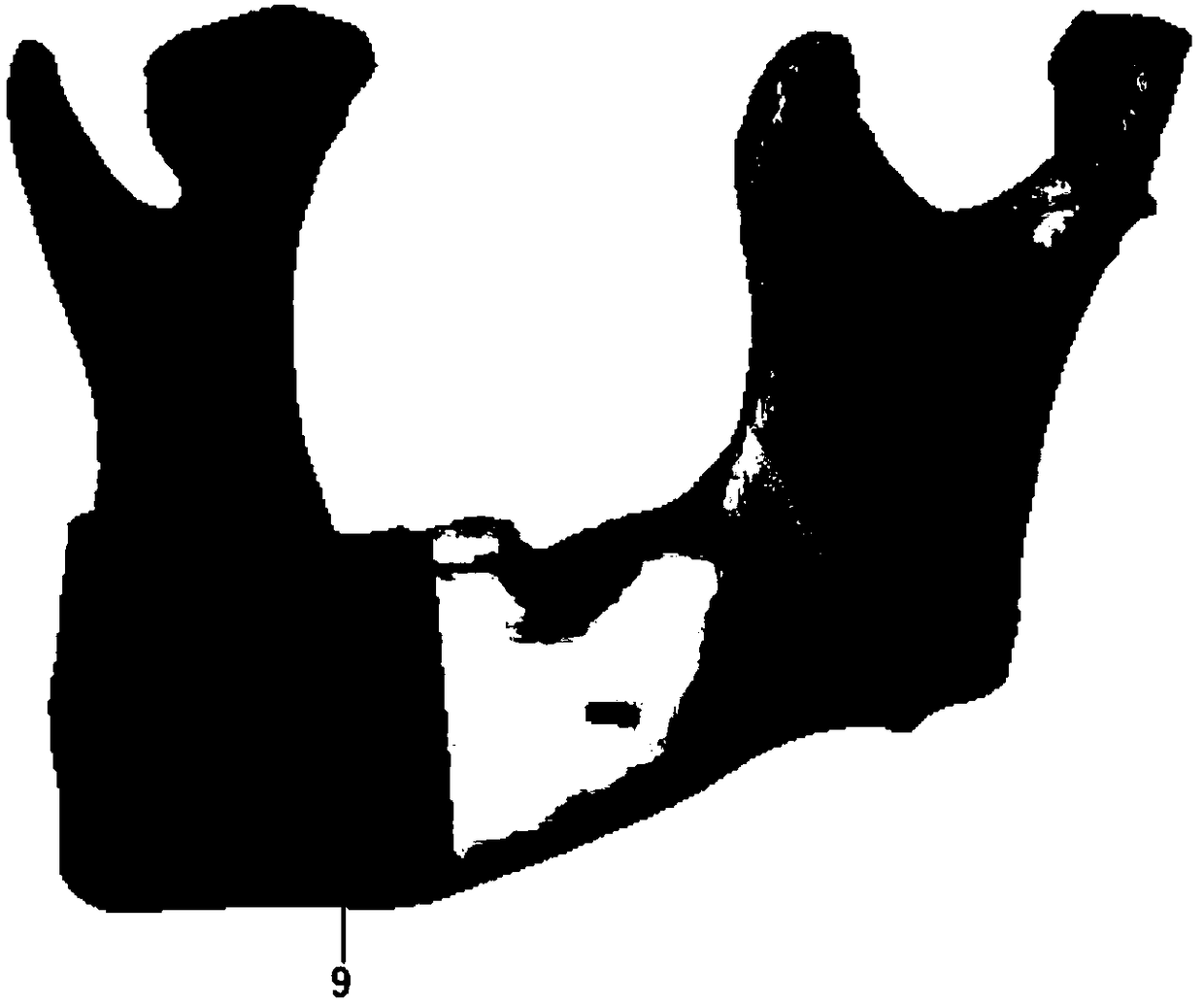 Lower jawbone position information recording method based on guide plate