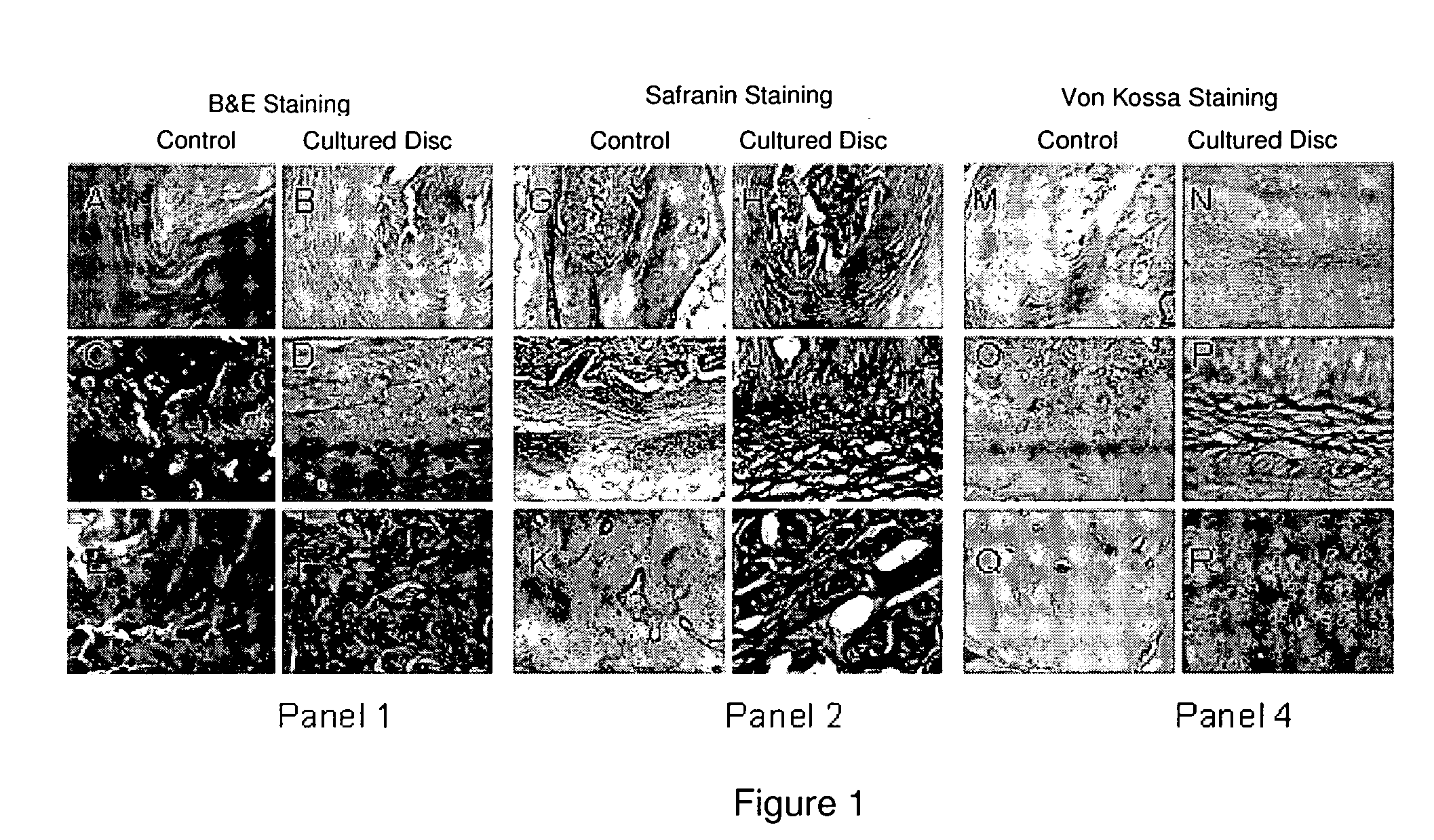 Human disc tissue