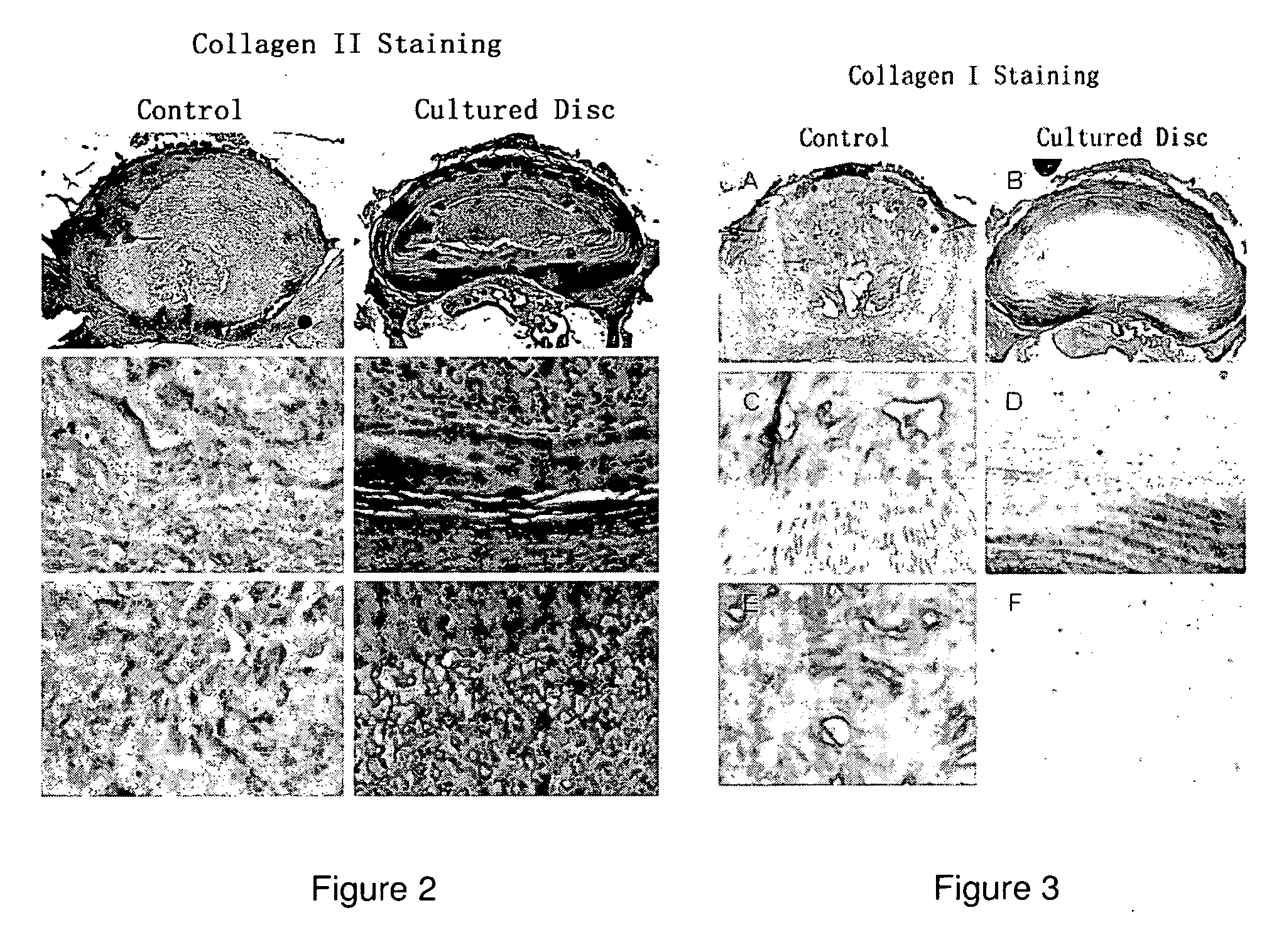 Human disc tissue