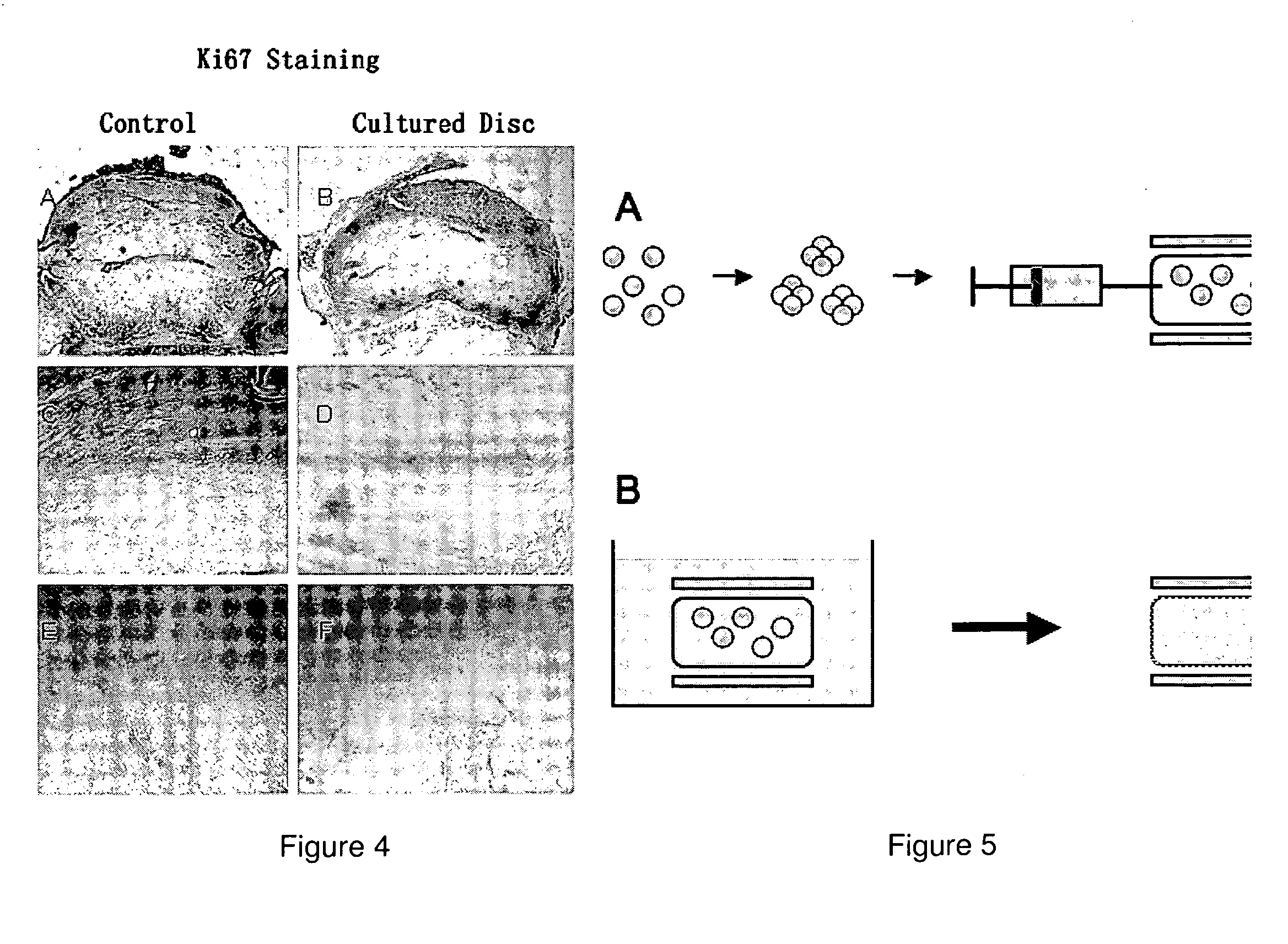 Human disc tissue