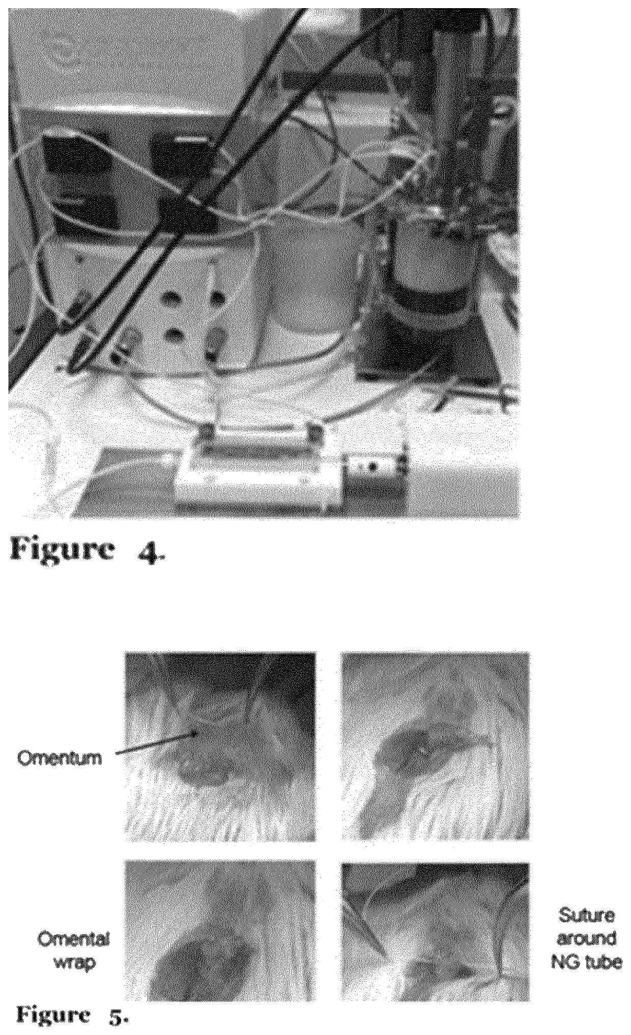 Tissue engineering