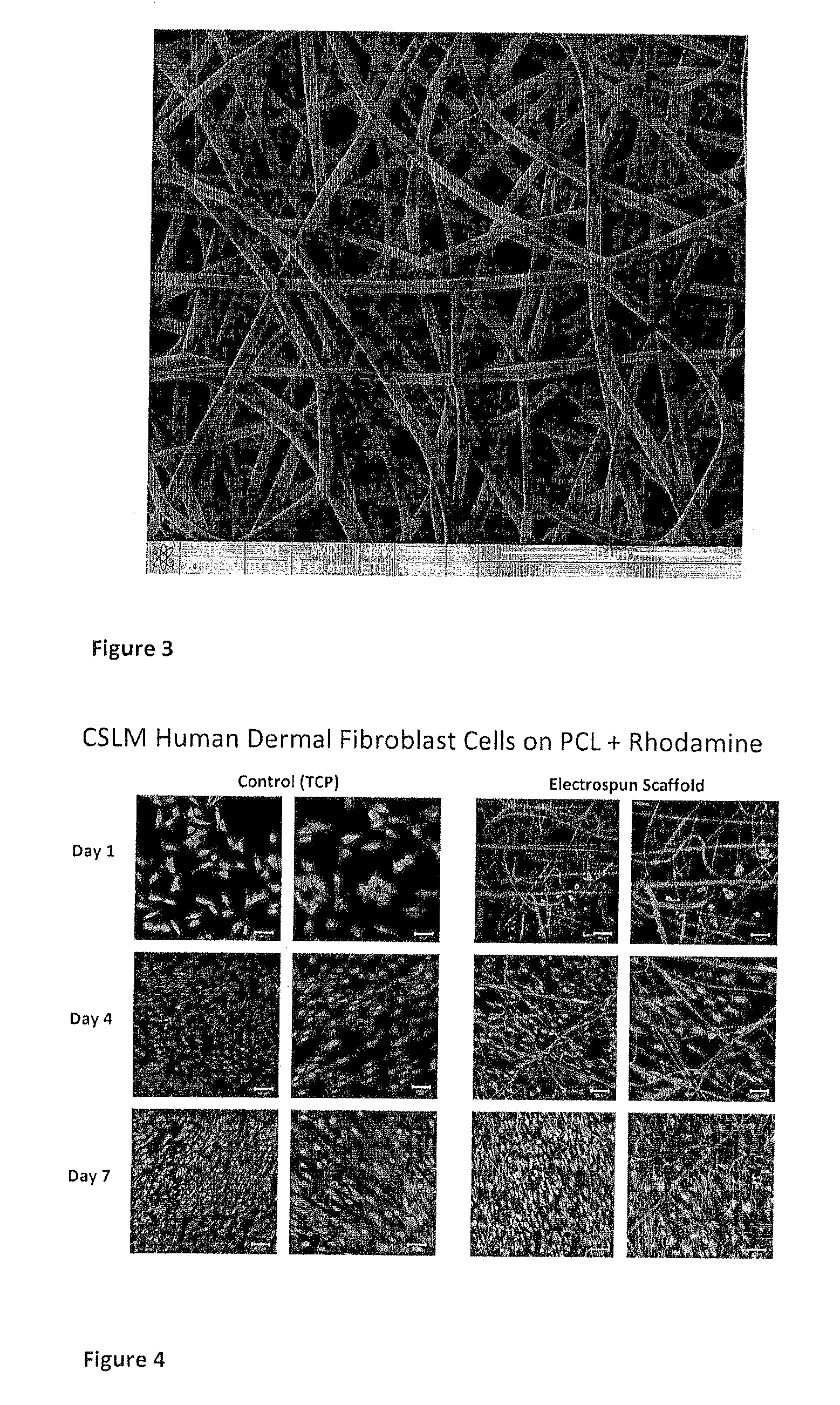 Method of forming a tissue scaffold