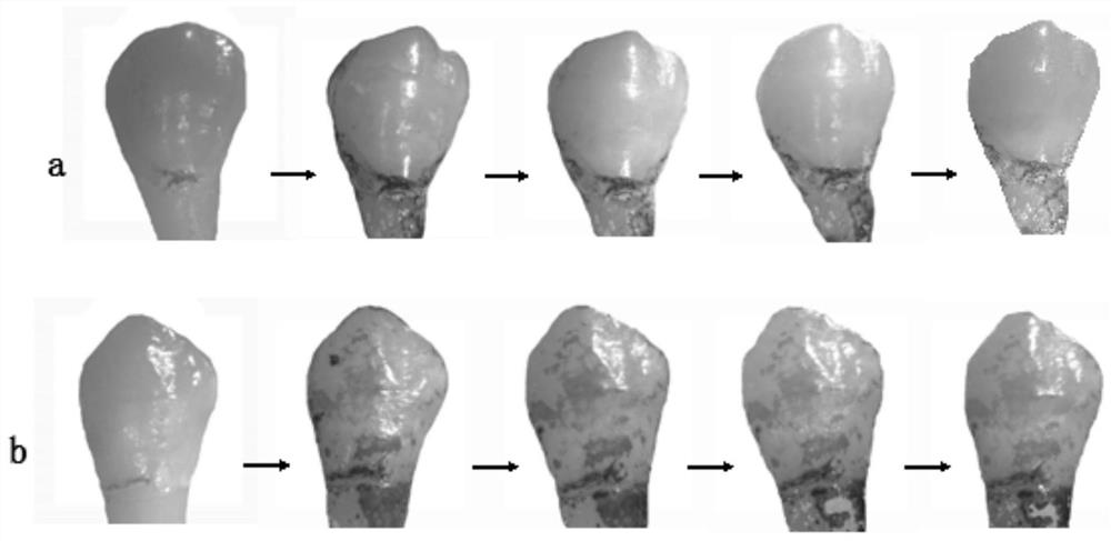 Tooth gel with remineralization capability, tooth paste and preparation method of tooth gel